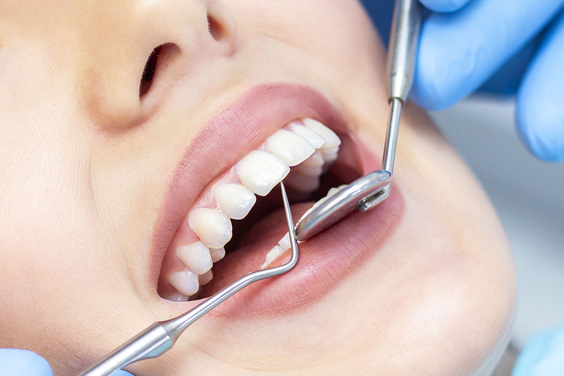Yaygın Diş Tedavileri